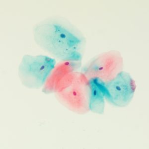 EA Counterstain, Gill's Modified Solution