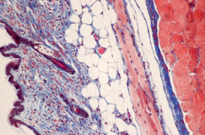 Lillie Modification of Masson's Trichrome