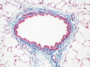 Masson's Trichrome for Connective Tissue