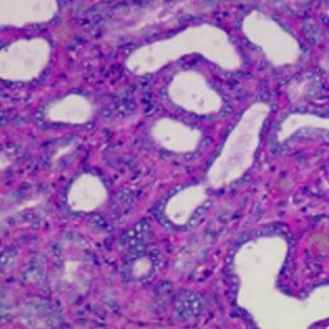 Eosin-Phloxine Counterstain