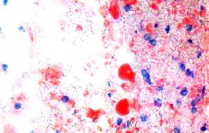 Oil Red O Method for Lipofuscin