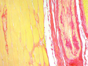 Picrosirius Red Staining of Cardiac